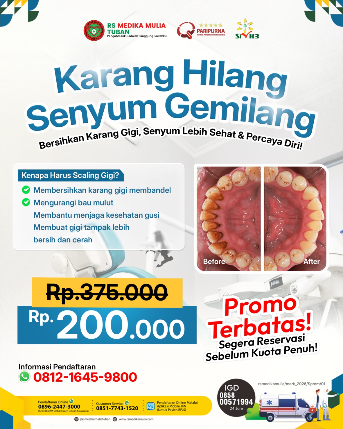 Promo Scalling Gigi